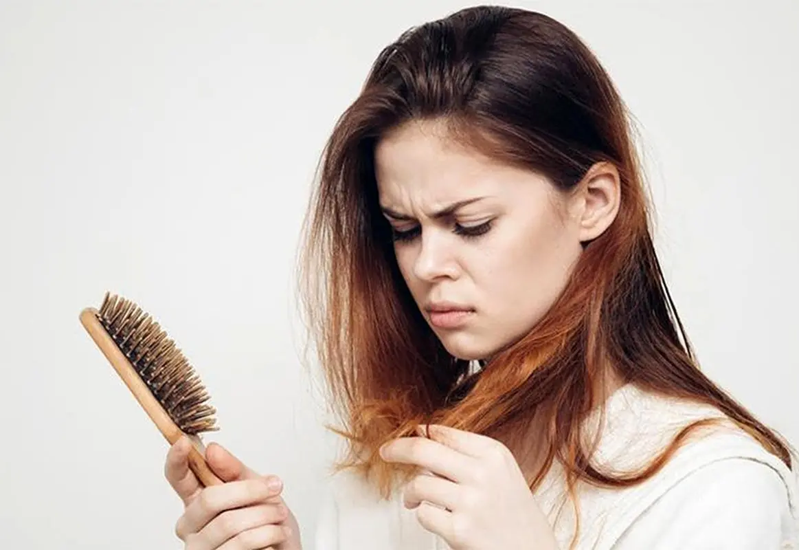 مهم ترین دلیل ریزش مو چیست؟ خانم ها بخوانند