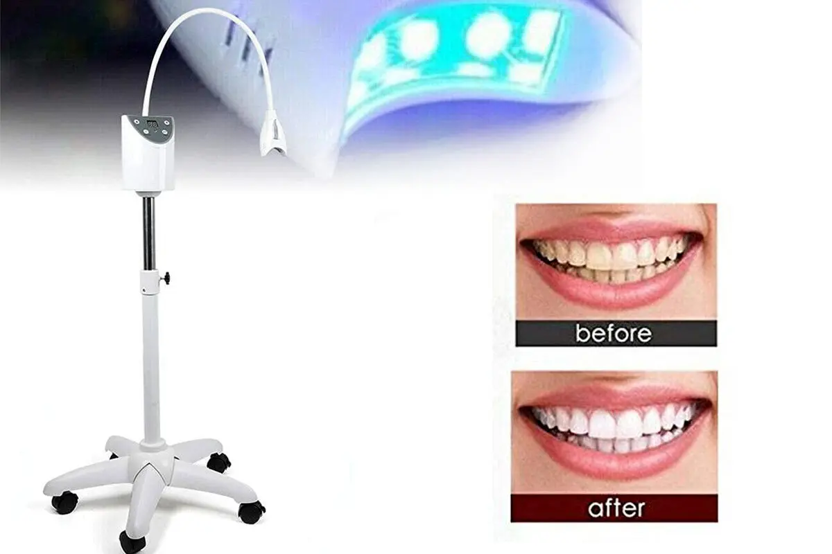 راهنمای جامع انتخاب و خرید بهترین دستگاه بلیچینگ دندانپزشکی