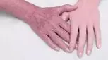 از پوست کرپی چه می‌دانید؟