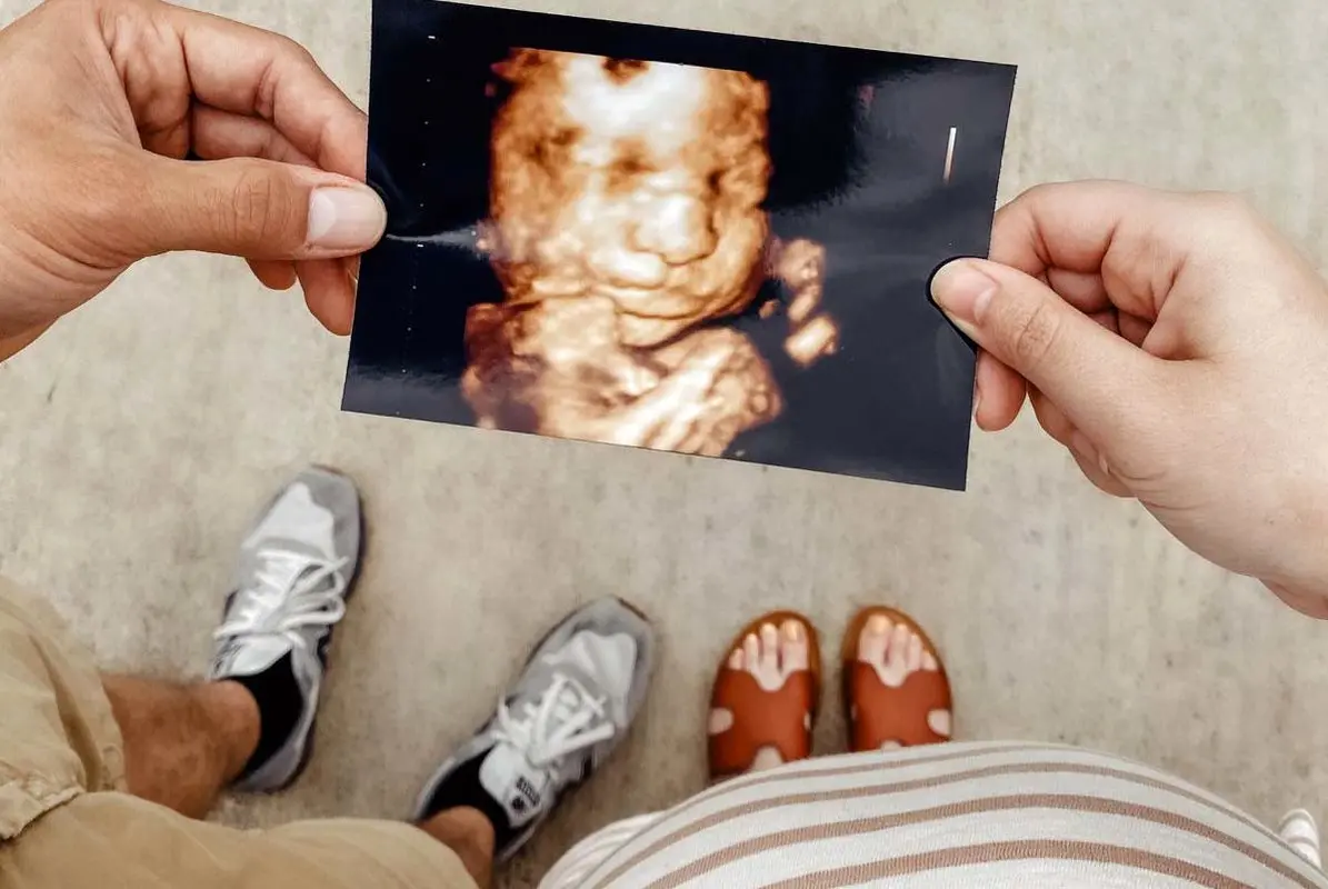 سونوگرافی دو بعدی، سه بعدی و چهار بعدی چه فرقی دارند؟