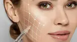 معرفی بهترین فیلرهای صورت؛ ویژگی‌ها و راهنمای انتخاب فیلر ماندگار