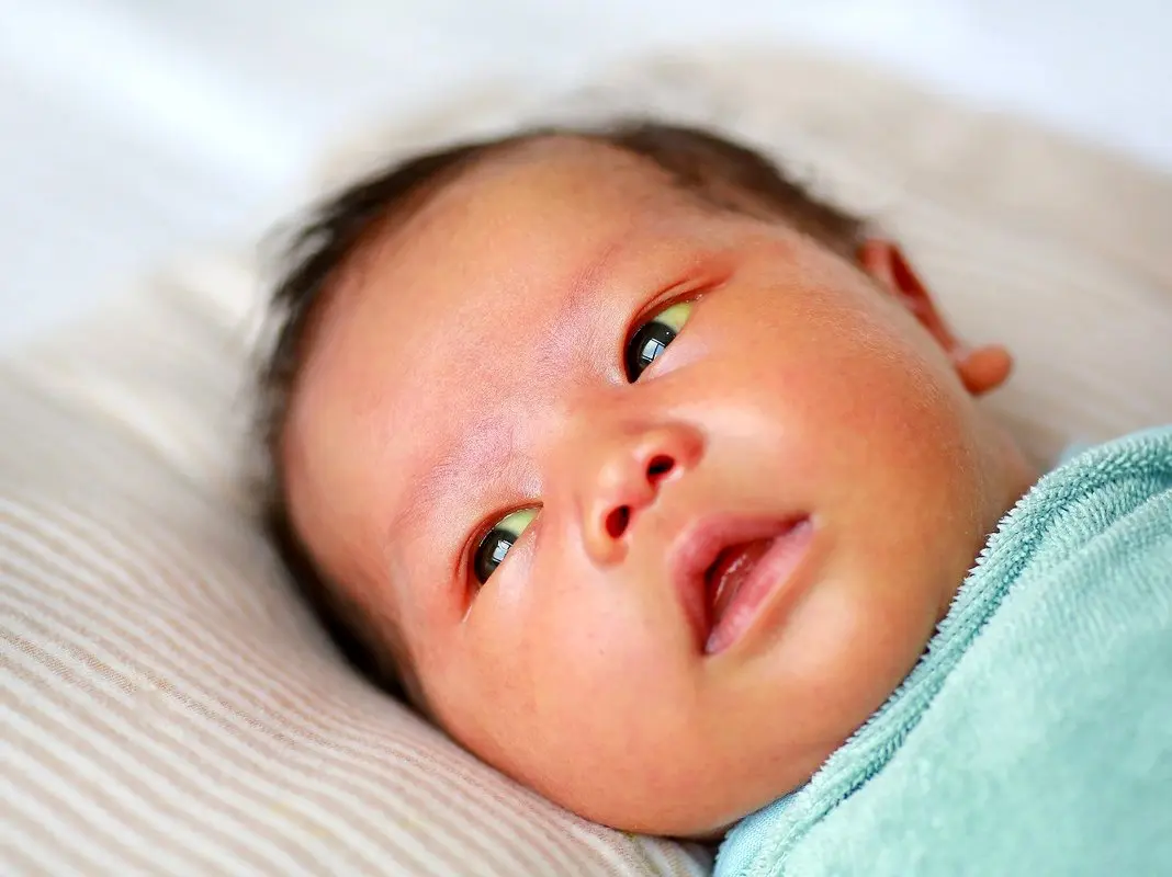 زردی نوزاد از علل تا روش‌های درمان