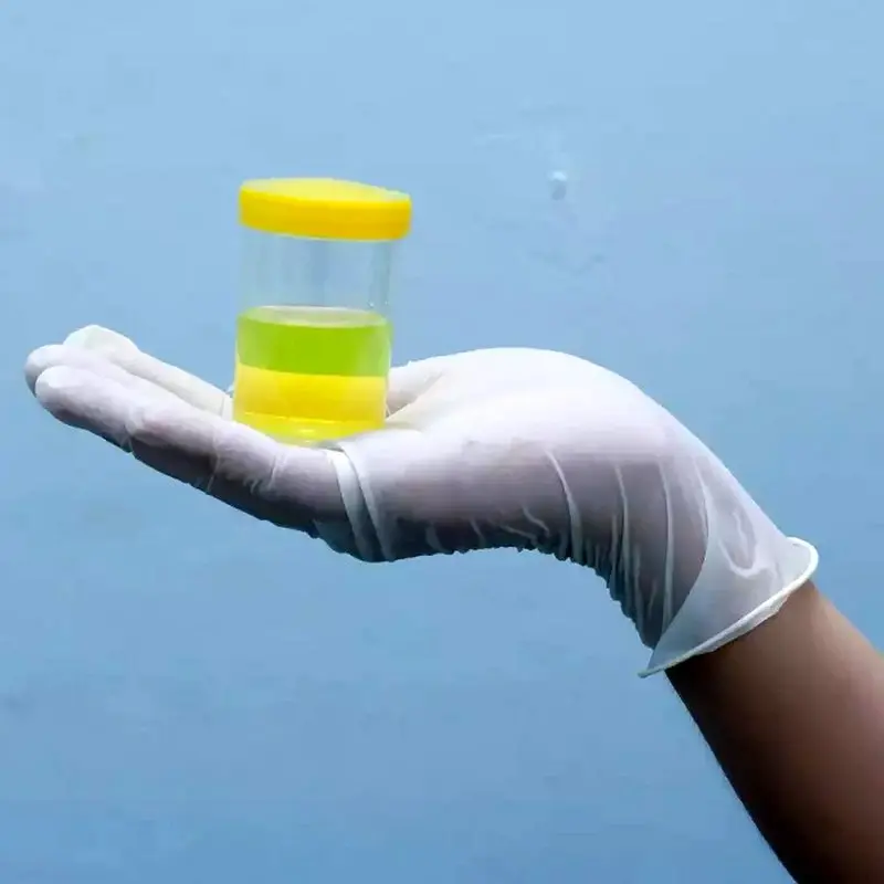 رنگ ادرار نشان دهنده چیست؟