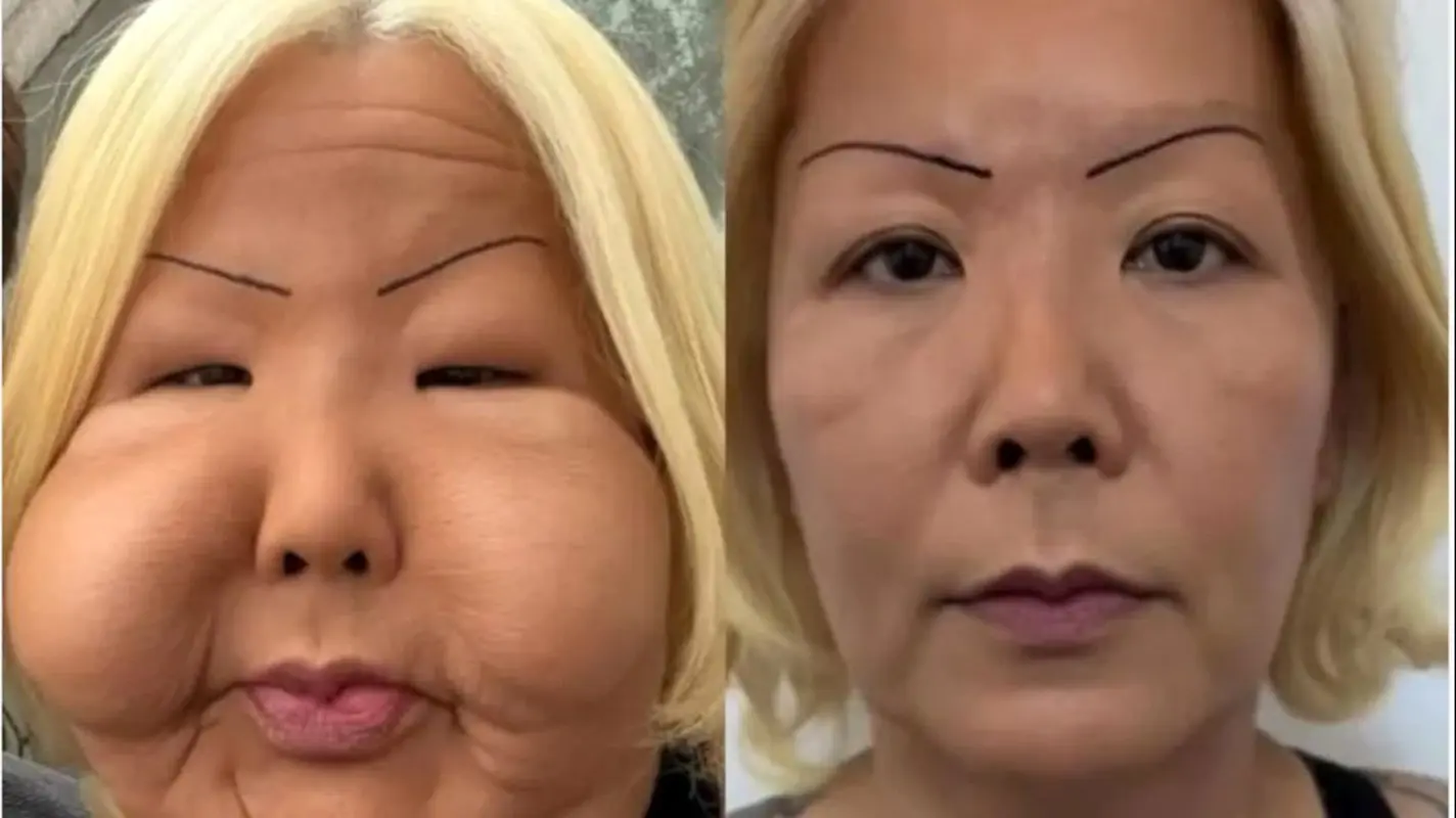 ببینید این اینفلوئنسر معروف برزیلی با عمل های زیبایی چه بلایی وحشتناکی سر صورتش آورد! (عکس)