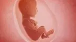 کاهش حجم مایع امنیوتیک، هر آنچه باید بدانید