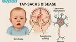 بیماری تای ساکس در کودکان _ علائم و علت + روش‌های درمان در هر سن