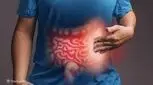 نشانه یک بیماری کشنده در روده بزرگ چیست؟