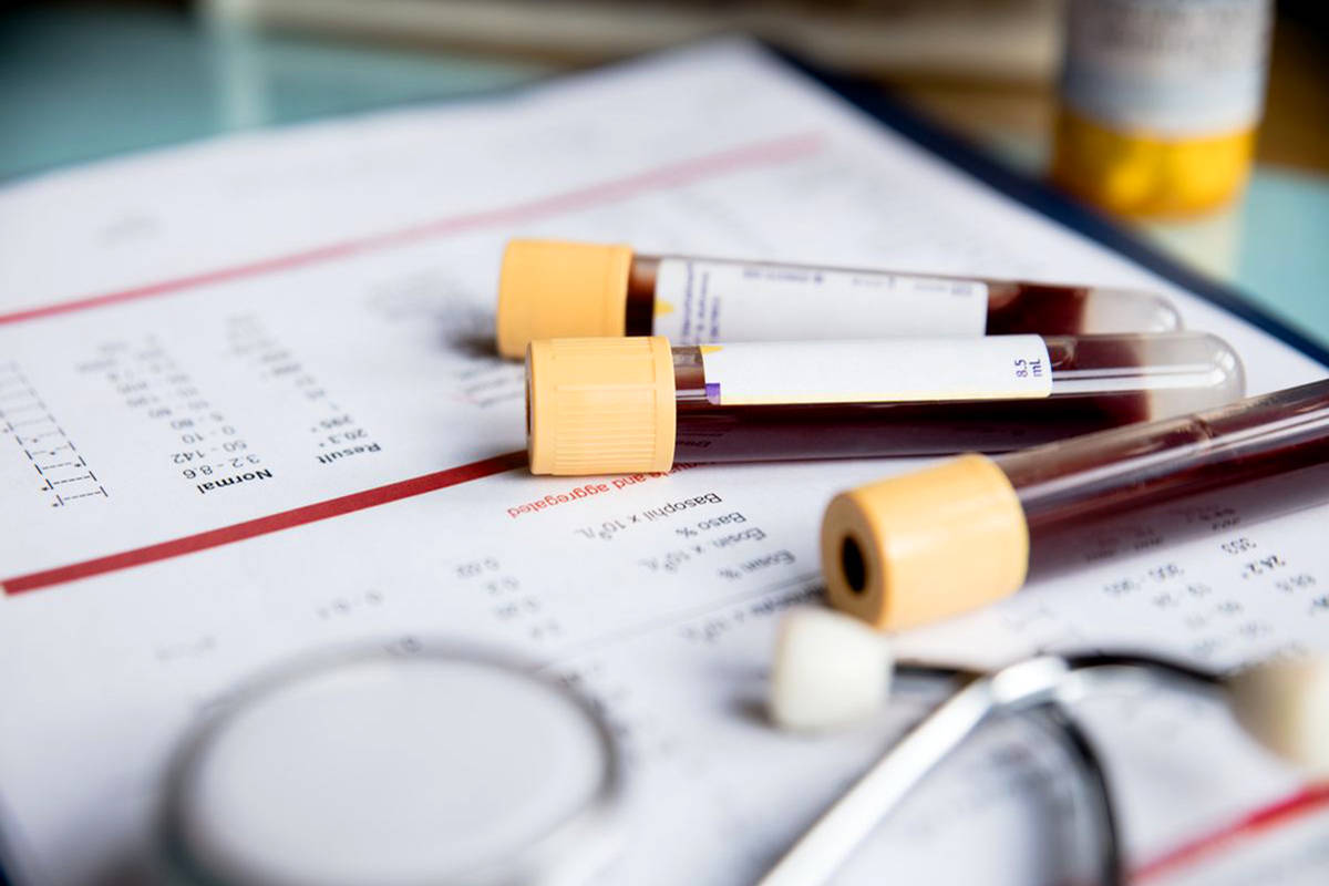 اهمیت انجام تست hpv