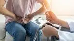 برگشت هموروئید بعد از عمل، احتمال دارد؟
