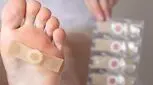 درمان زگیل های پوستی، راحت تر از آن است که فکر می کنید