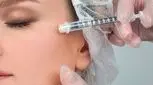 تزریق ژل گونه و صورت، مزایا، عوارض و میزان ماندگاری!