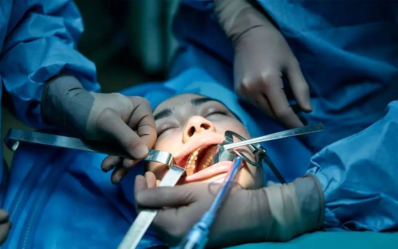 بهترین سن برای جراحی لوزه در کودکان کدام است؟