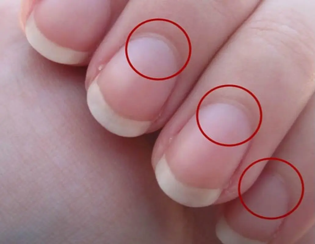 رازهای مهم هلال سفید انتهای ناخن