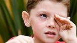 مالش چشم را جدی بگیرید/ می‌تواند نشانه آلرژی باشد