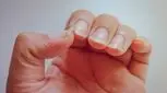 آیا یائسگی باعث خشکی ناخن‌ها می‌شود؟
