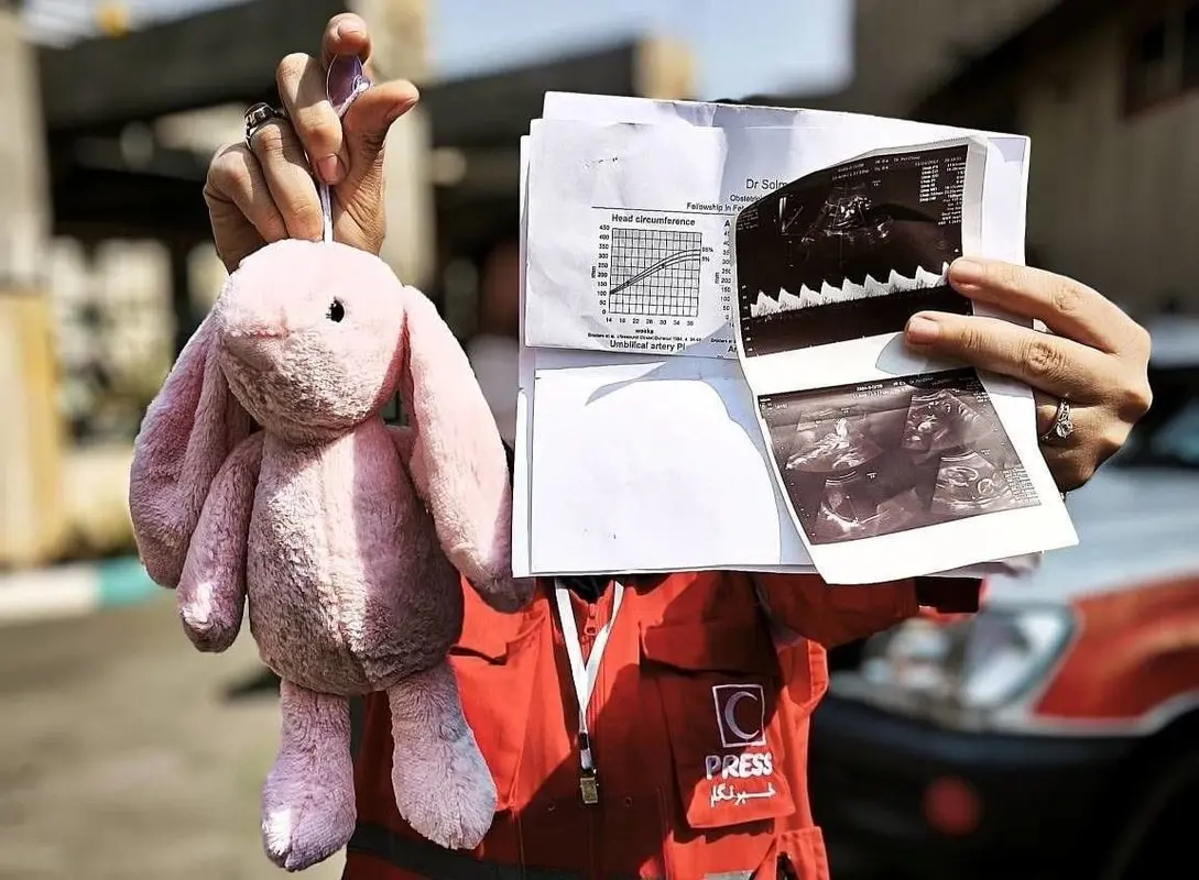برگه سونوگرافی حاملگی کنار پیکر یک زن در زیر آوار جنگ