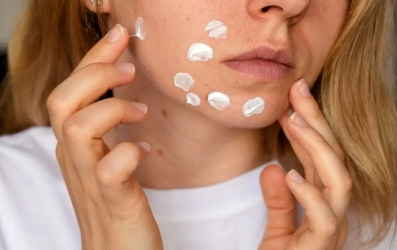 هشدار متخصصان پوست/ هیالورونیک‌اسید برای نوجوانان مناسب نیست