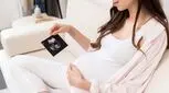 روش تشخیص سندروم داون در بارداری