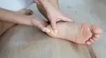 خاری که خیلی درد دارد/ با خار پاشنه پا چه کنیم؟