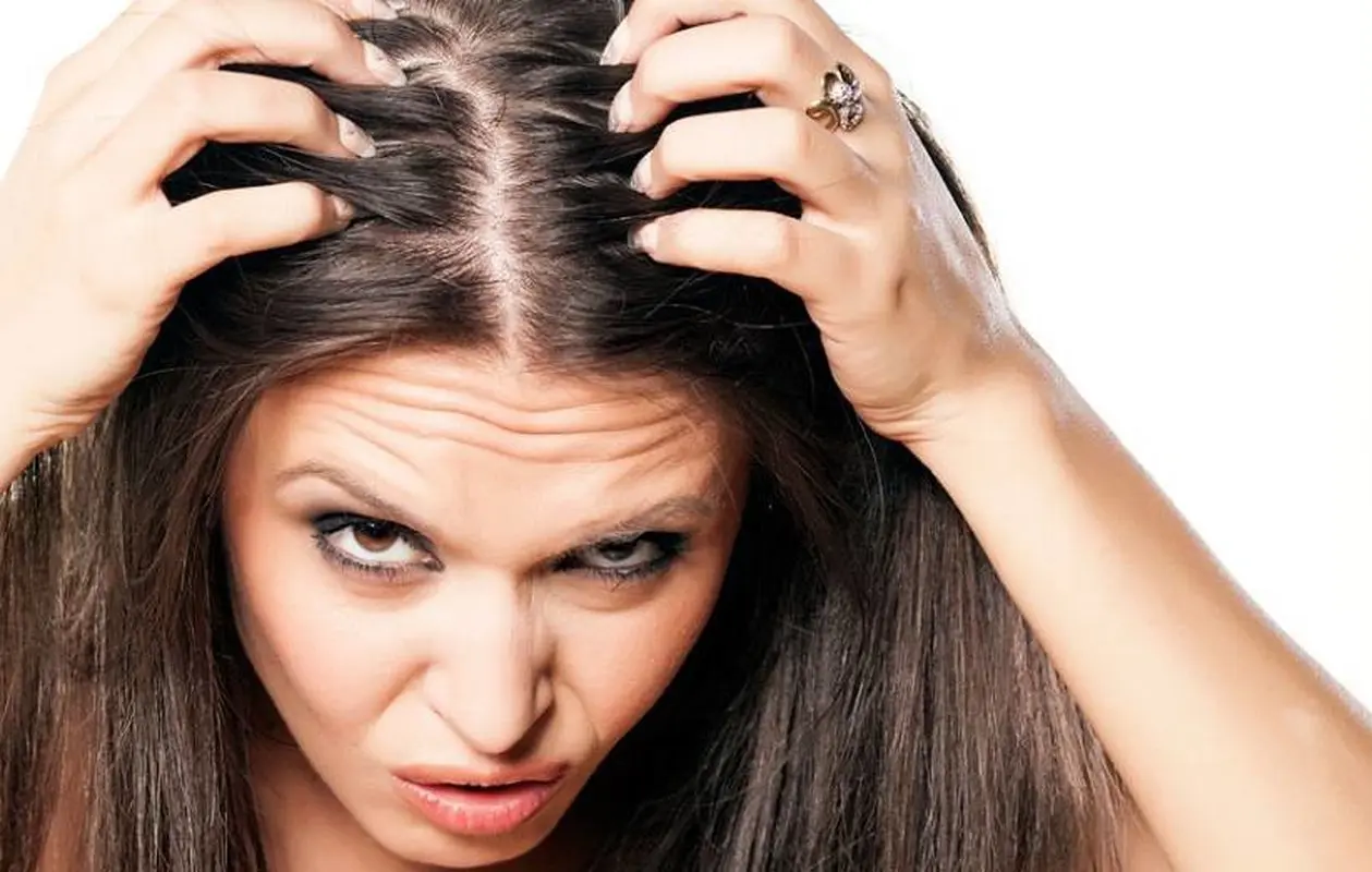 آشنایی با درمان خانگی خارش پوست سر