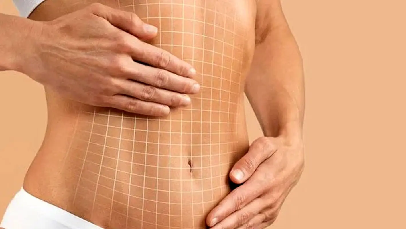 بهترین مرکز اندولیفت شکم در تهران 