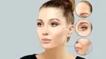آیا بوتاکس عوارض دارد؟