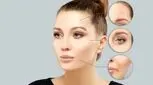 آیا بوتاکس عوارض دارد؟