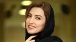 زیبایی خیره کننده سمیرا حسینی بعداز جدیدترین تزریق ژل ! + عکس ها