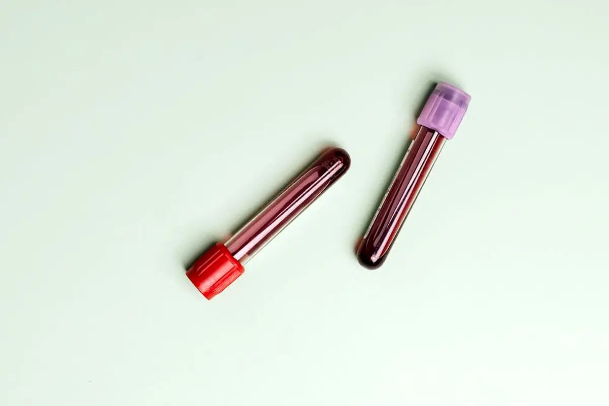 اهمیت تست یو بی تی در آزمایش تشخیص میکروب معده