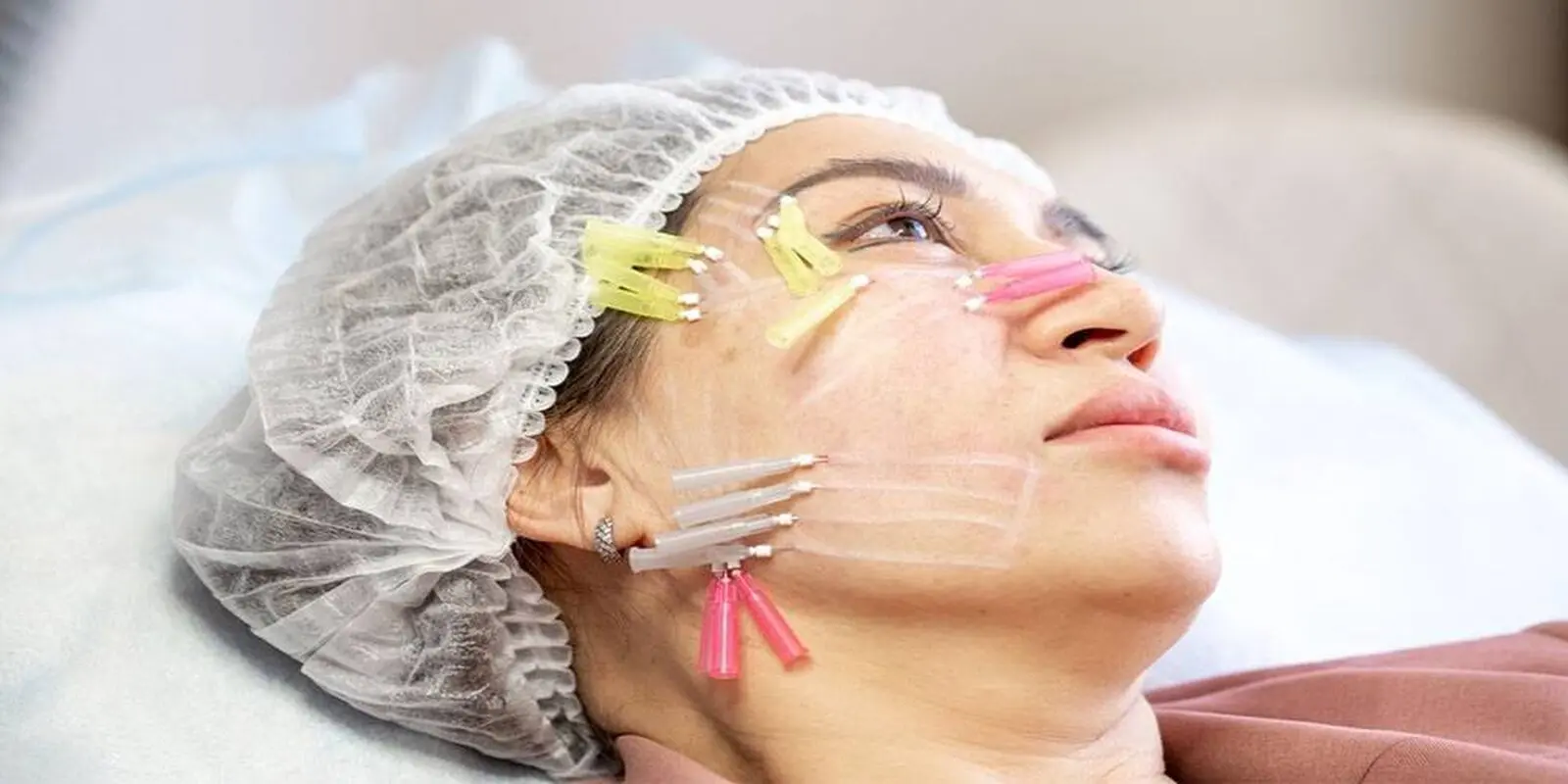 امبدینگ چیست و چطور لاغر می‌کند؟