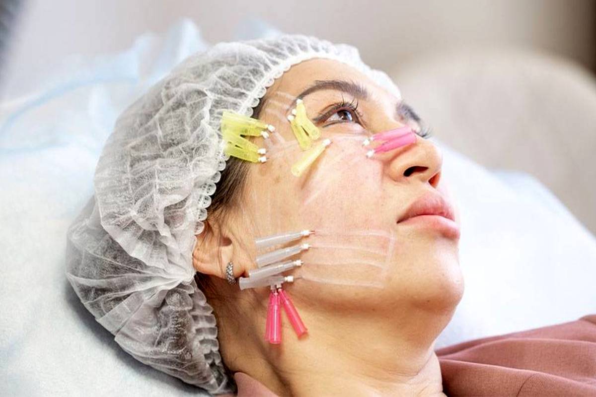امبدینگ چیست و چطور لاغر می‌کند؟