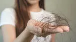 چگونه از نازک شدن و ریزش مو جلوگیری کنیم؟