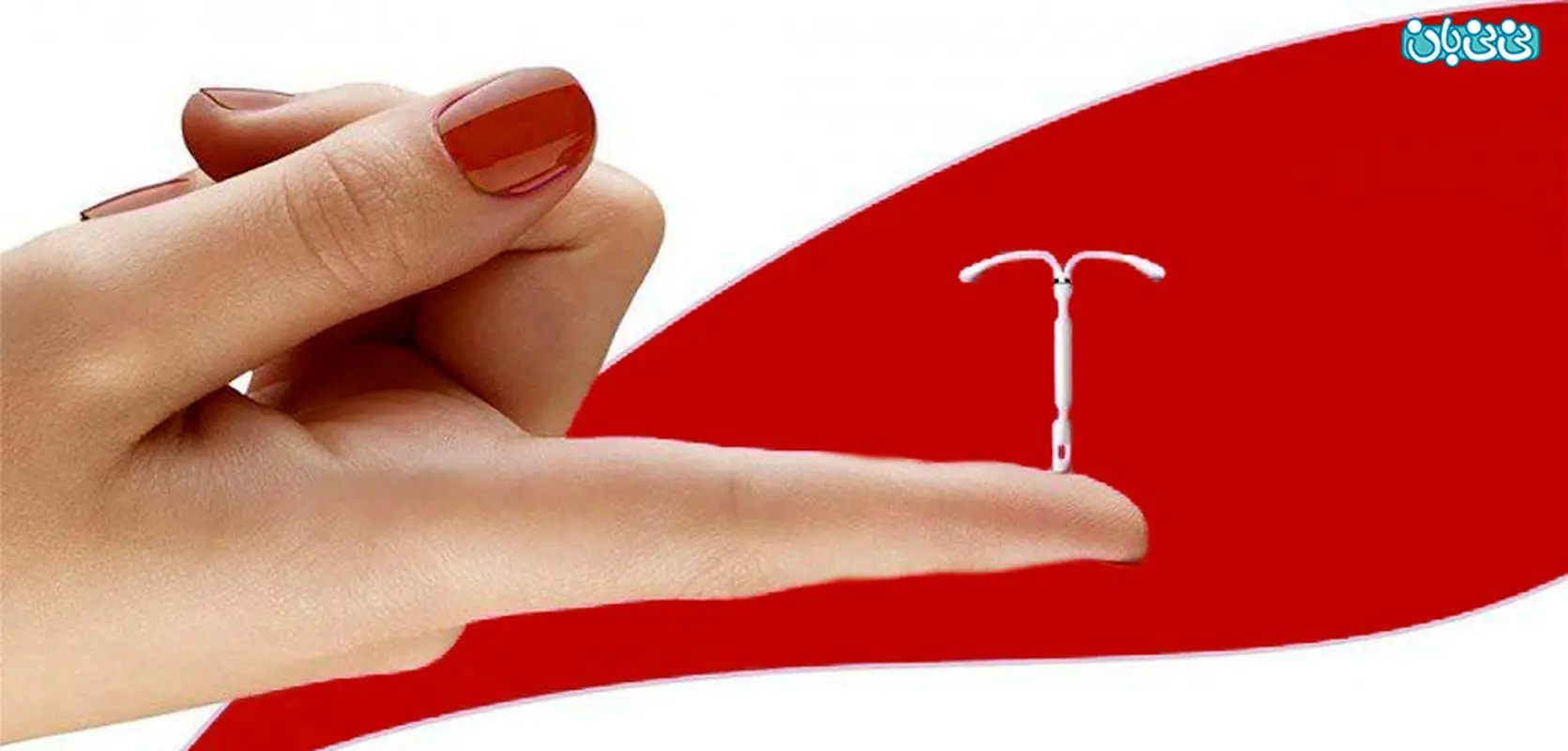 بهترین روش جلوگیری از بارداری پس از زایمان چیست؟