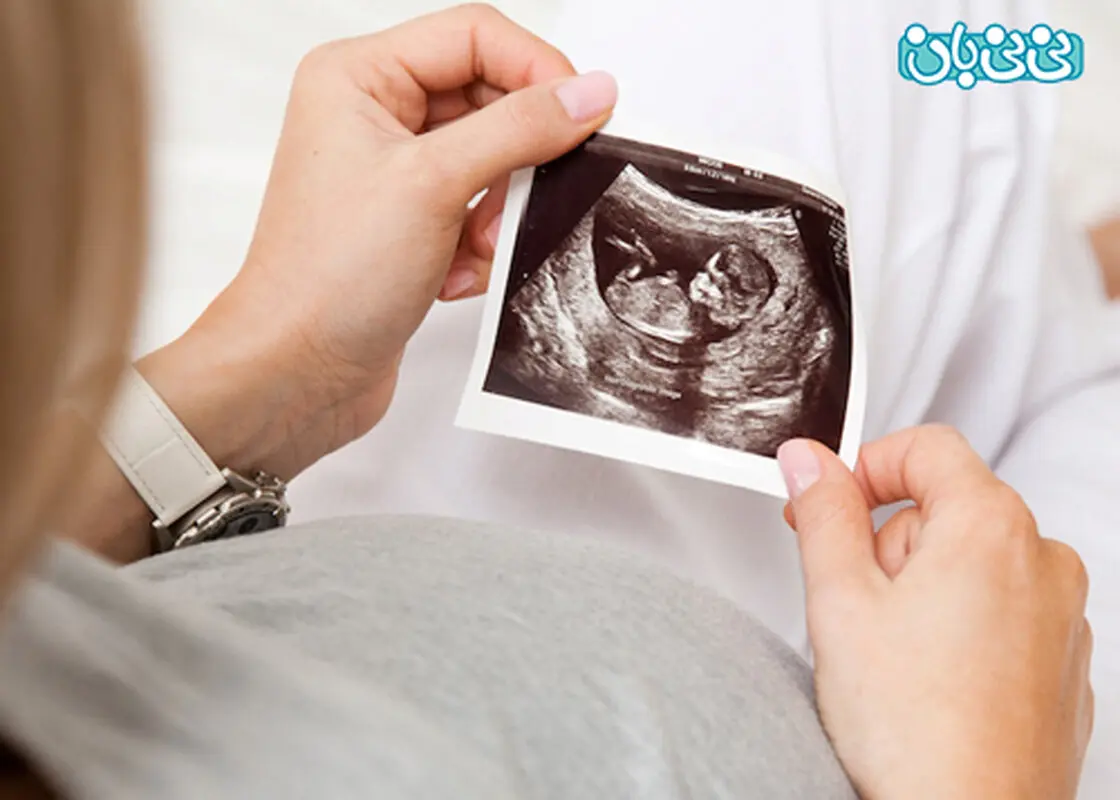 صدای قلب جنین کی شنیده می‎شود؟