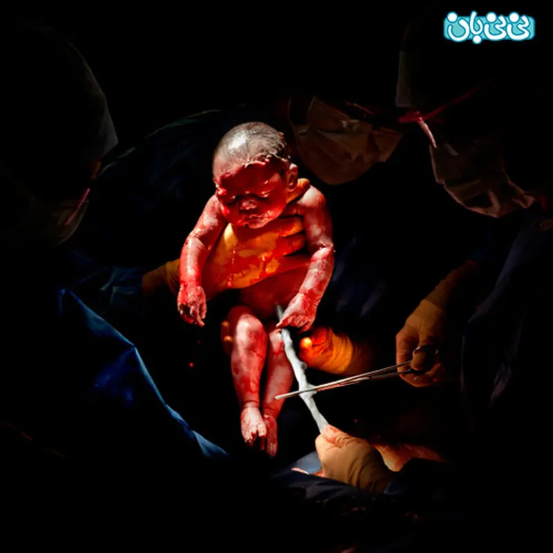 اولین لحظه تولد نوزاد، پروژه عکاسی