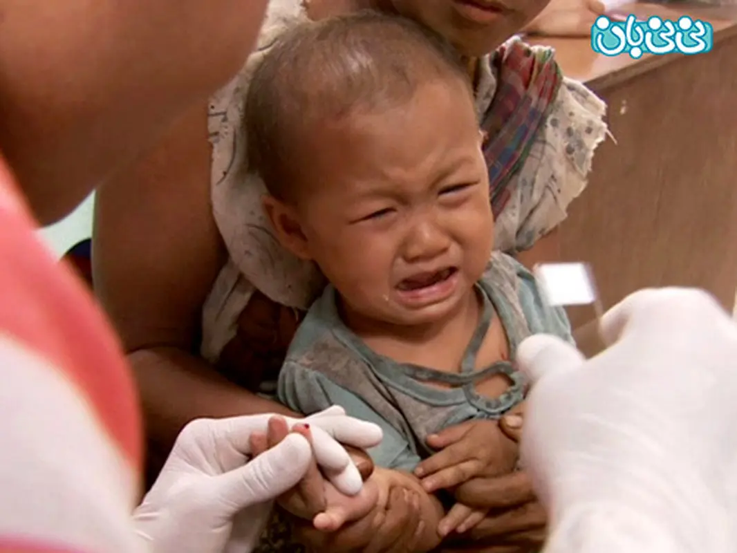 علائم مالاریا در کودکان، چیست؟