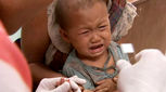 علائم مالاریا در کودکان، چیست؟