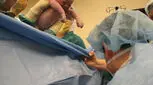 عوارض زایمان سزارین، احتمال بروز سه نوع عفونت