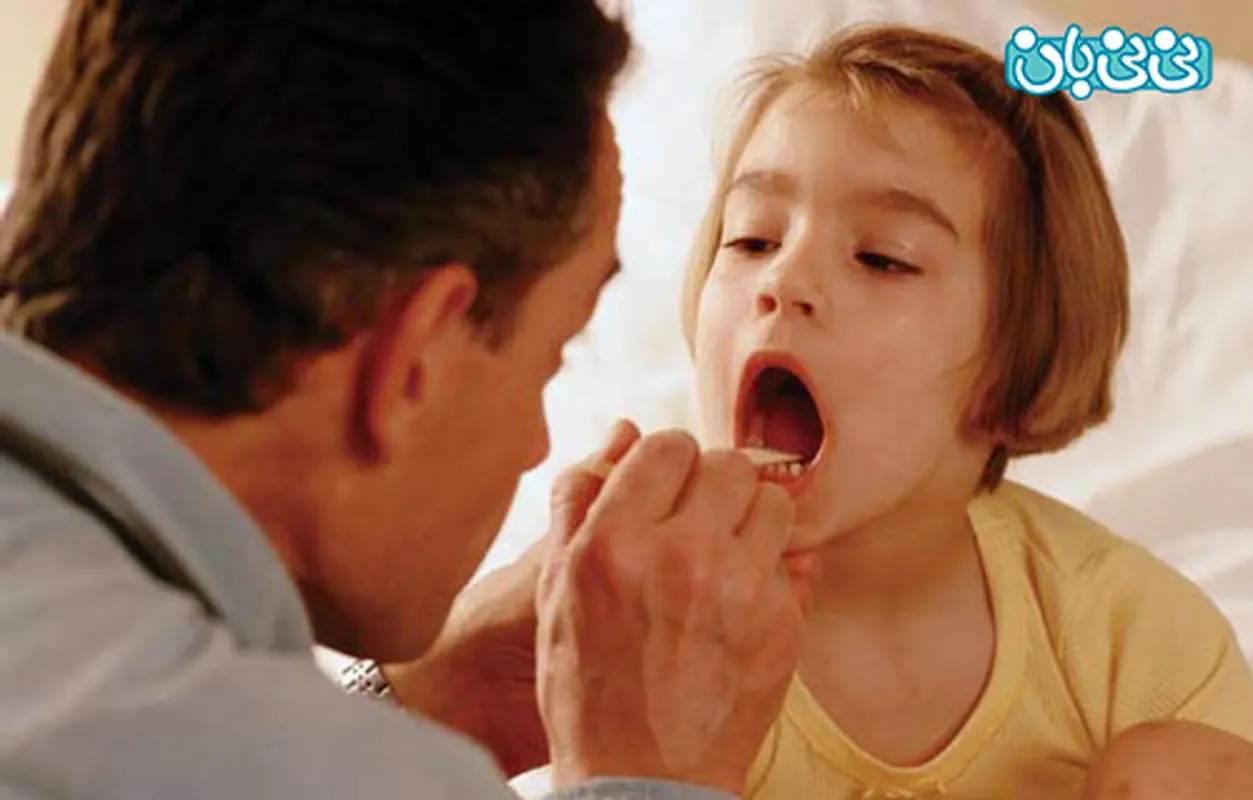 گلودرد چرکی کودکان، عامل ایجاد