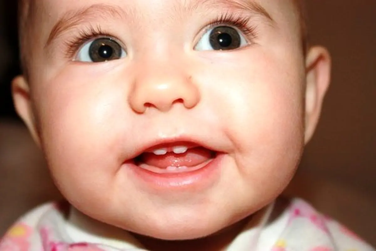 مراقبت از دندان شیری کودکان، چقدر اهمیت دارد؟