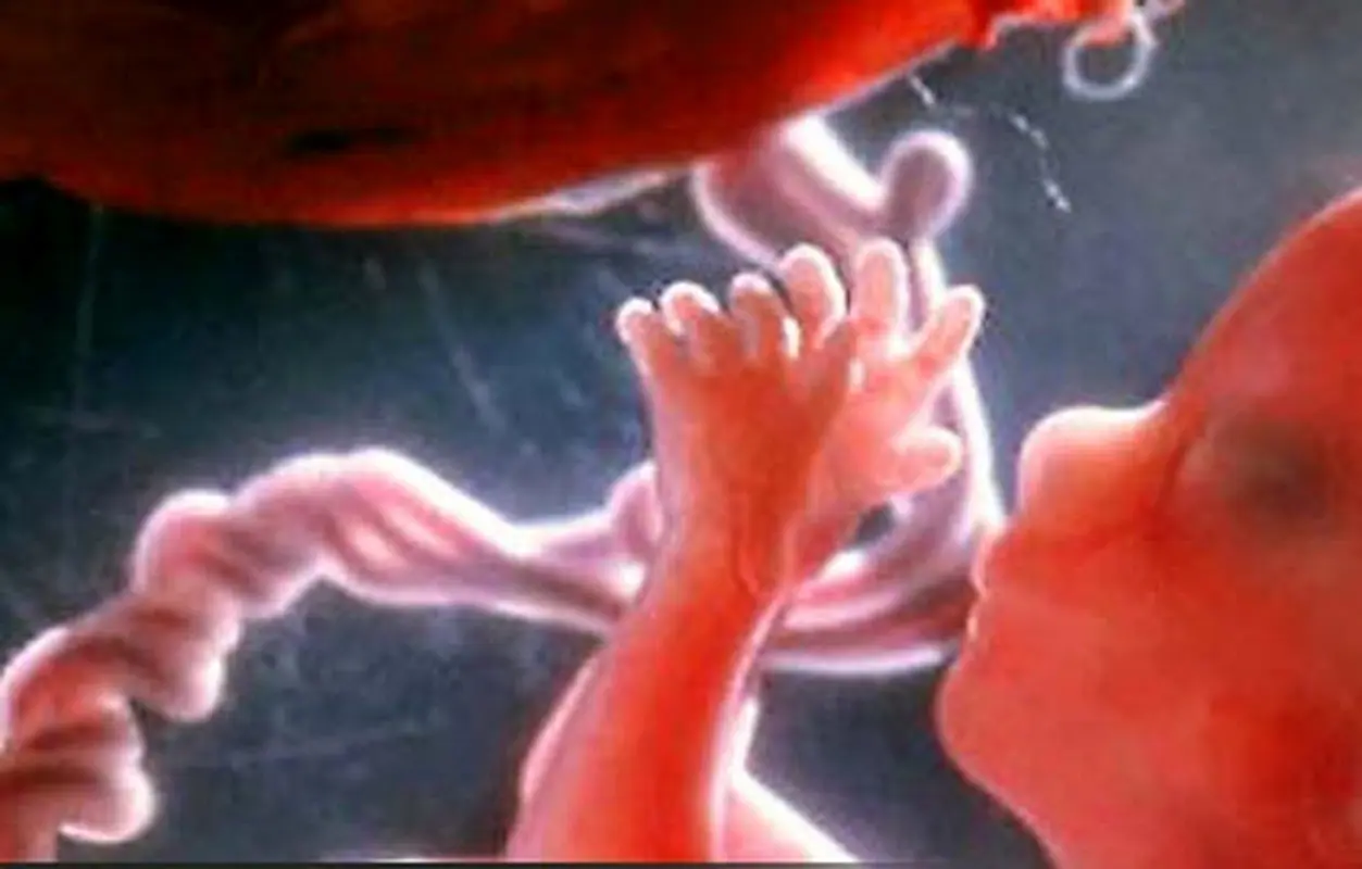 پیچ خوردگی بند ناف، چه عوارضی دارد؟