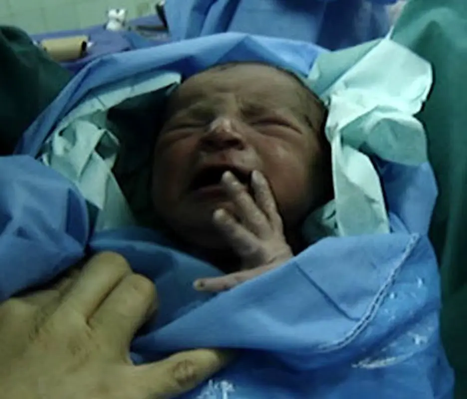 فرق زایمان طبیعی با سزارین چیست؟