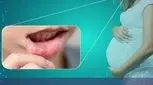 همه چیز درباره آفت دهان در دوران بارداری 