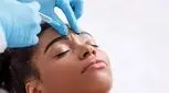 احتیاط کنید/ استفاده غیرمجاز از سم بوتولینوم در برخی آرایشگاه‌ها