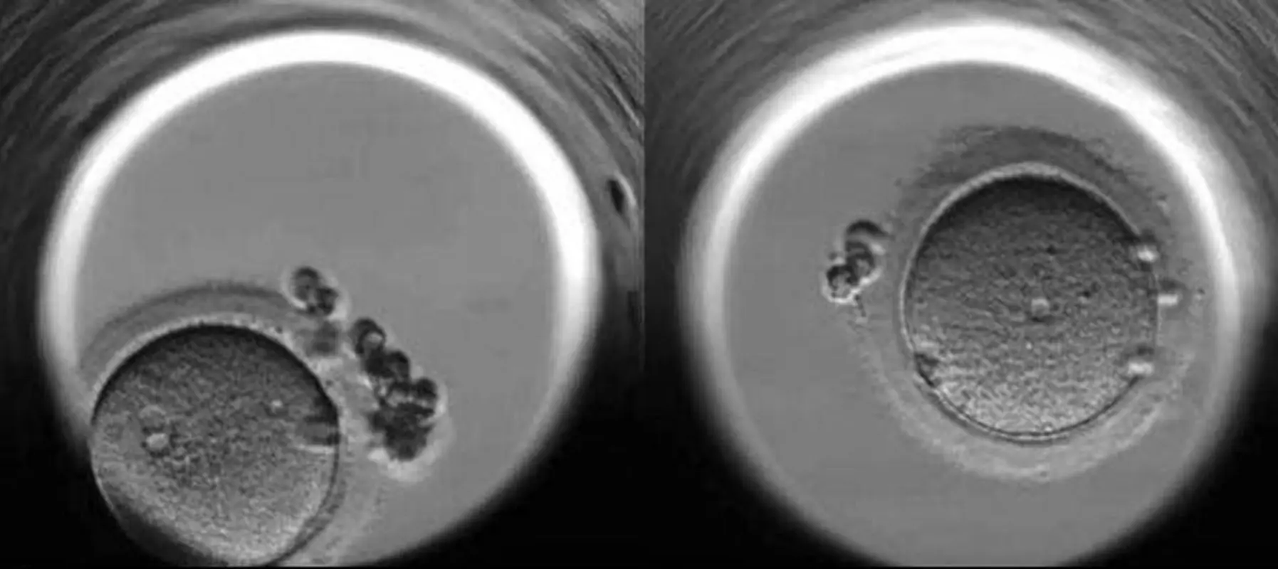 از شکل گیری لقاح تا رشد جنین، تصاویری که تا به حال ندیده اید!