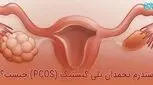 قاعدگی‌ نامنظم، باعث نازایی می شود؟
