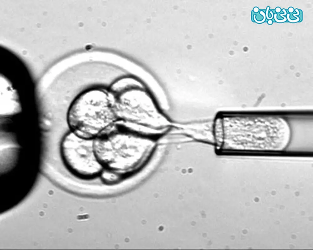 مقایسه تاثیر Double IUI و Single IUI در درمان نازایی
