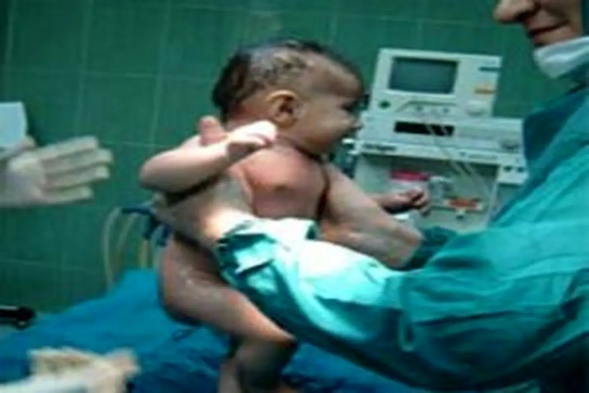 پیوند رحم زنان، آخرین امید برای مادر شدن!