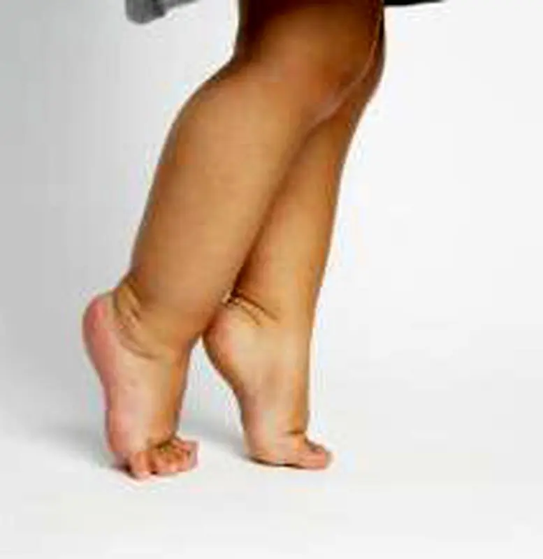 راه رفتن روی پنجه، درمان