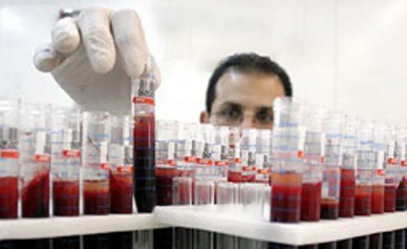 فواید بند ناف نوزاد، این بیماری درمان میشود!